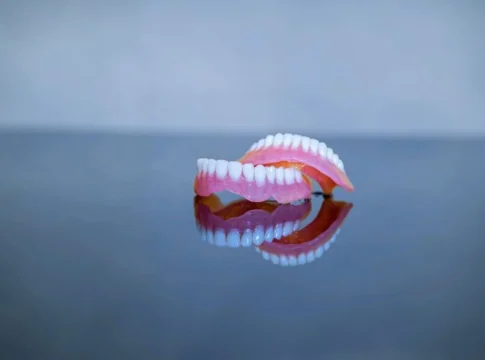 Dental bridge treatment planning with a dental model at City Dental Clinic in Tirana