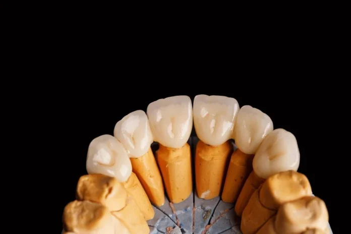 Dental crown treatment planning at City Dental Clinic in Tirana