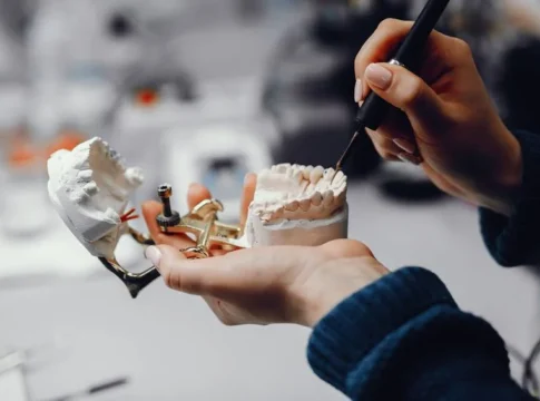 Artificial jaw model used to explain orthognathic treatment planning
